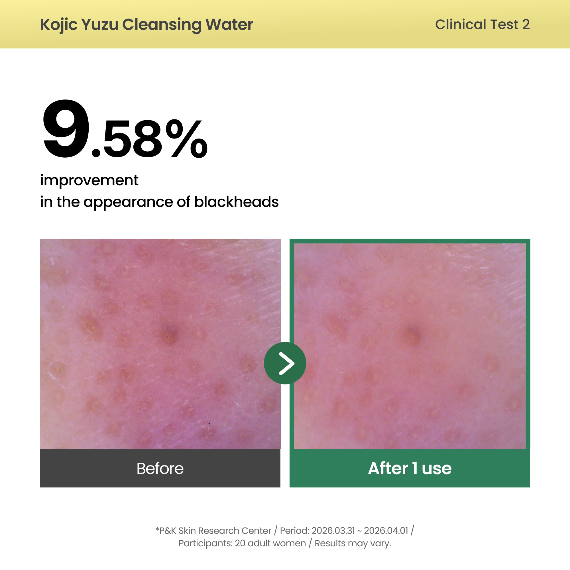 AXIS-Y Kojic Yuzu Cleansing Water