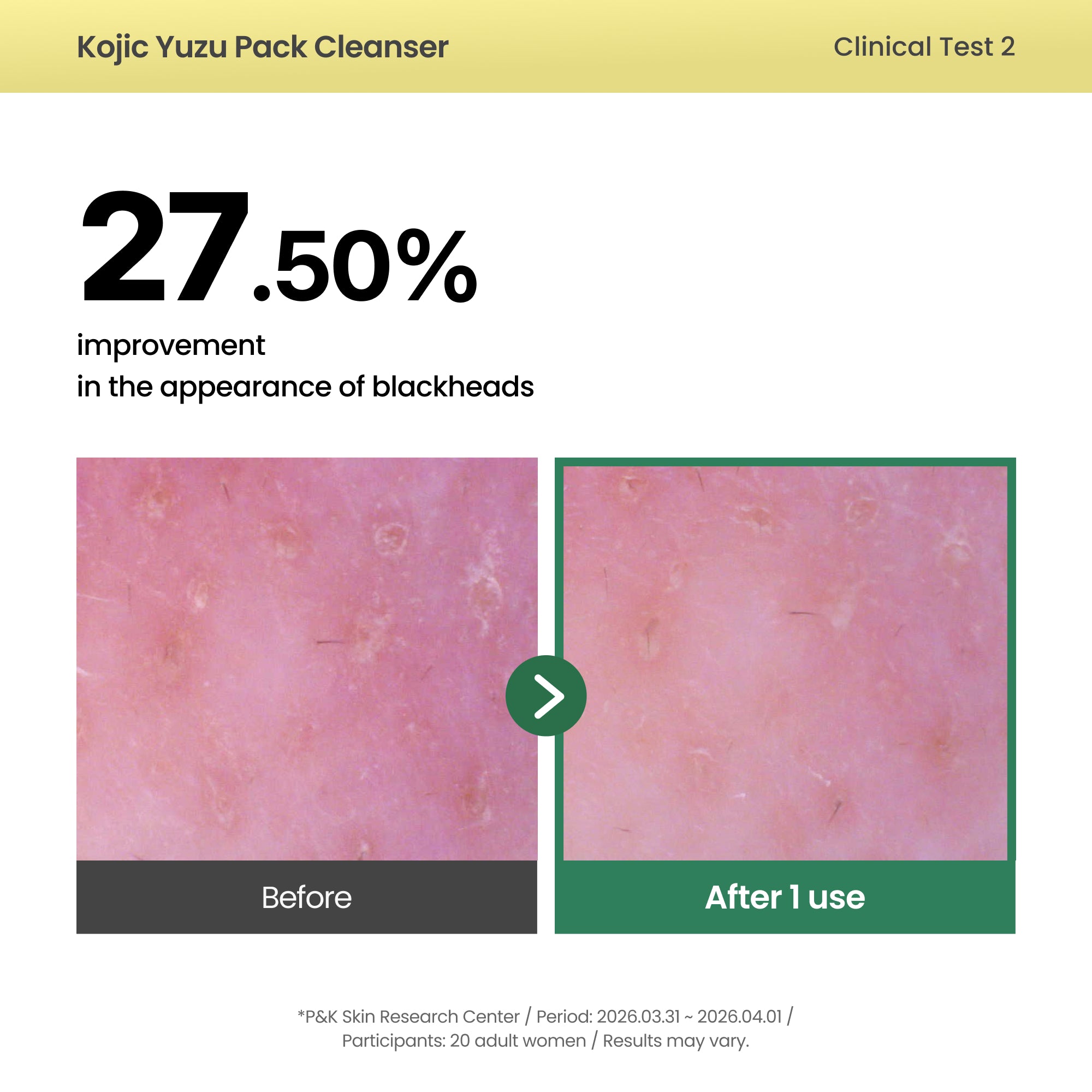 AXIS-Y Kojic Yuzu Pack Cleanser