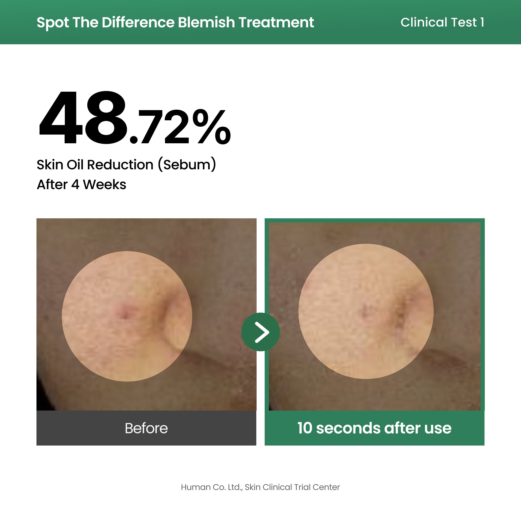 AXIS-Y Spot The Difference Blemish Treatment