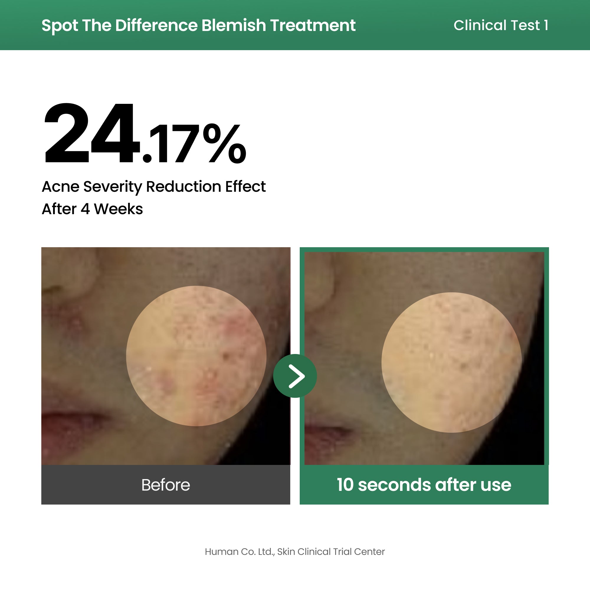 AXIS-Y Spot The Difference Blemish Treatment