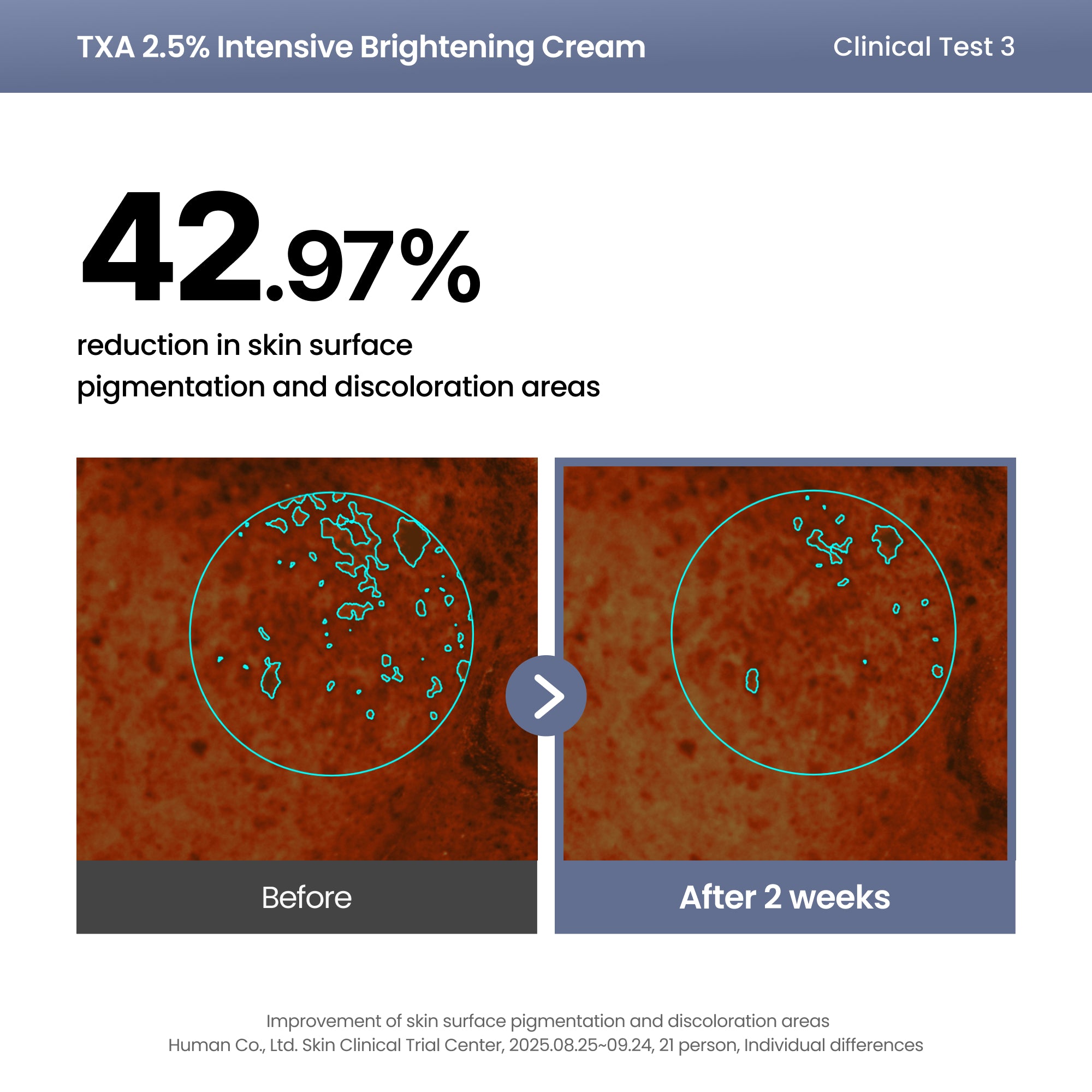 AXIS-Y TXA 2.5% Intensive Brightening Cream