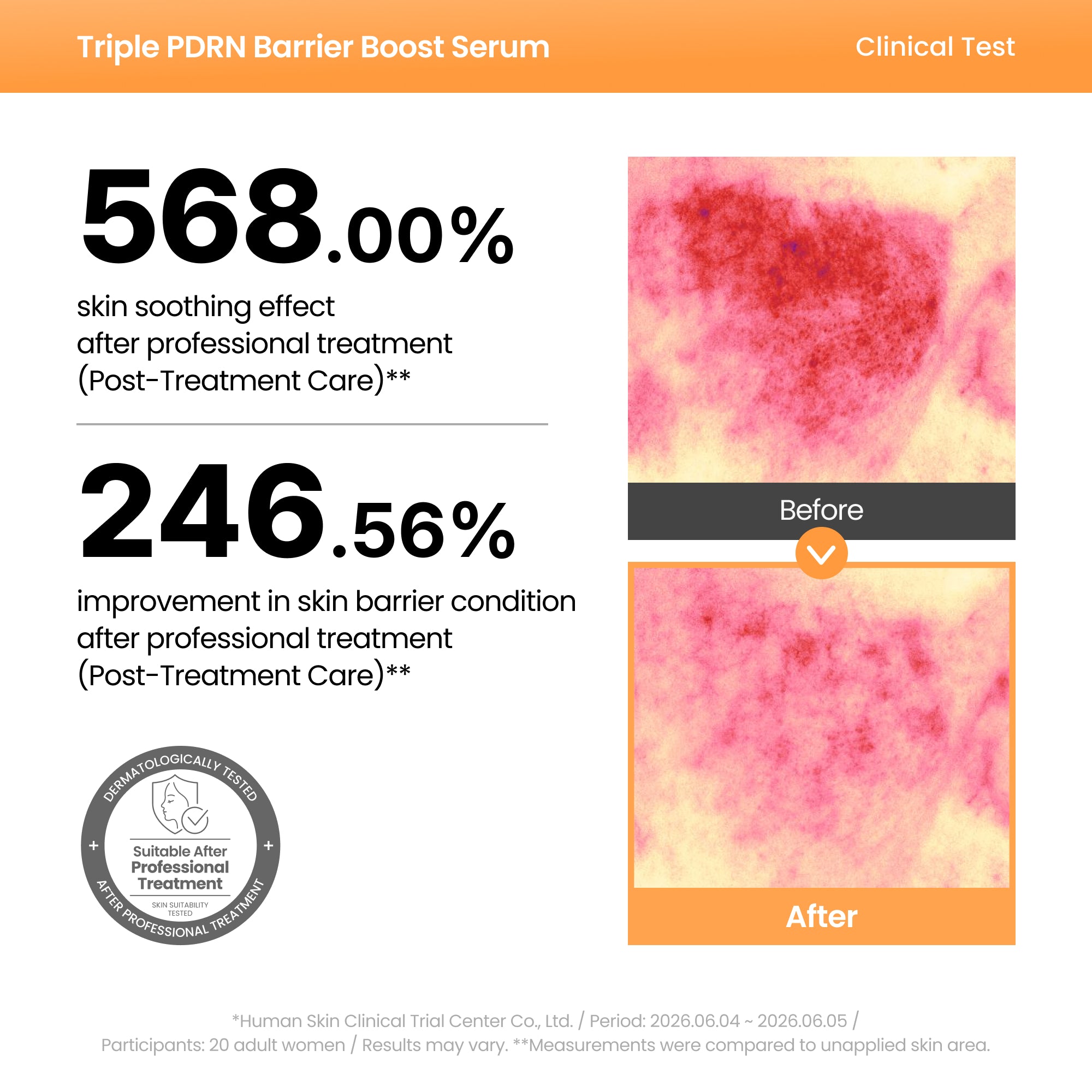 AXIS-Y Triple PDRN Barrier Boost Serum